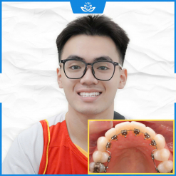 z7500886168772_16a5182aefe90b9ca611af22d0e645f7