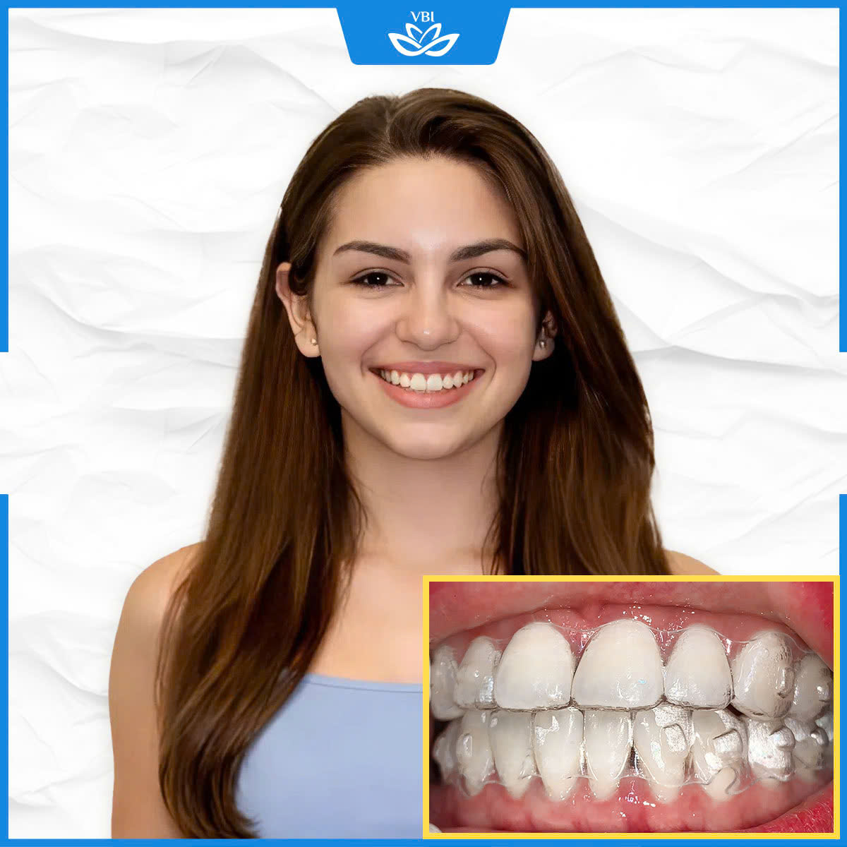 z7703180216425_dff2b2a27d863f8b5e0b4ce4762ffab5