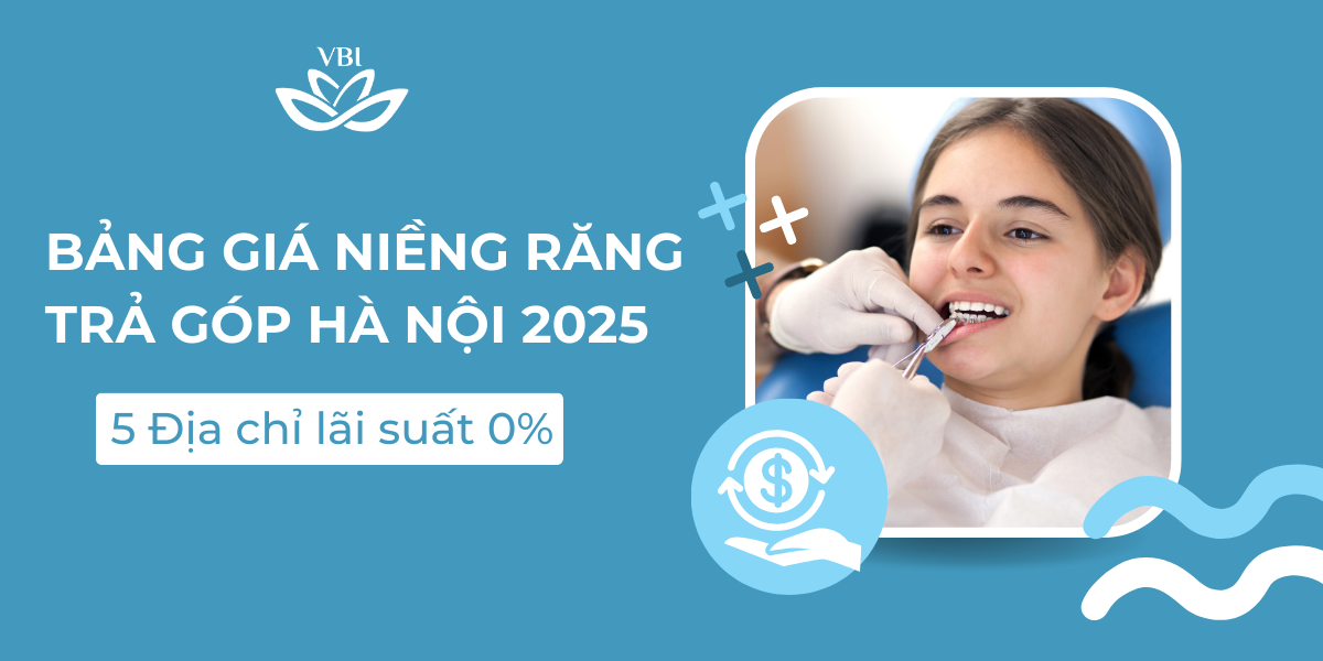 Bang-gia-nieng-rang-tra-gop-o-Ha-Noi
