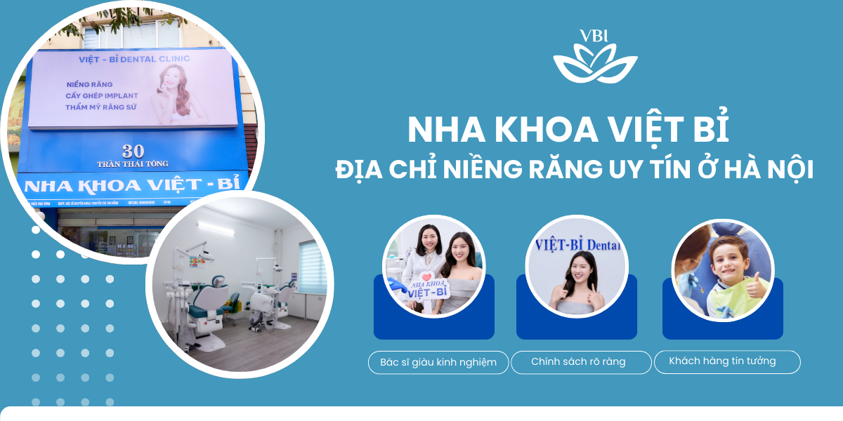 Nha-khoa-Viet-Bi-Dia-chi-nieng-rang-uy-tin-o-Ha-Noi