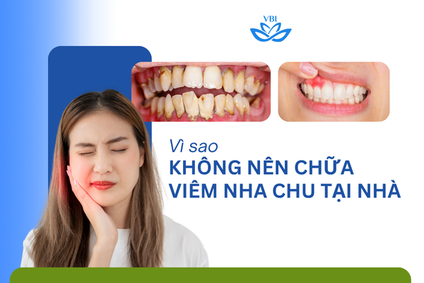 Vi-sao-khong-nen-chua-viem-nha-chu-tai-nha