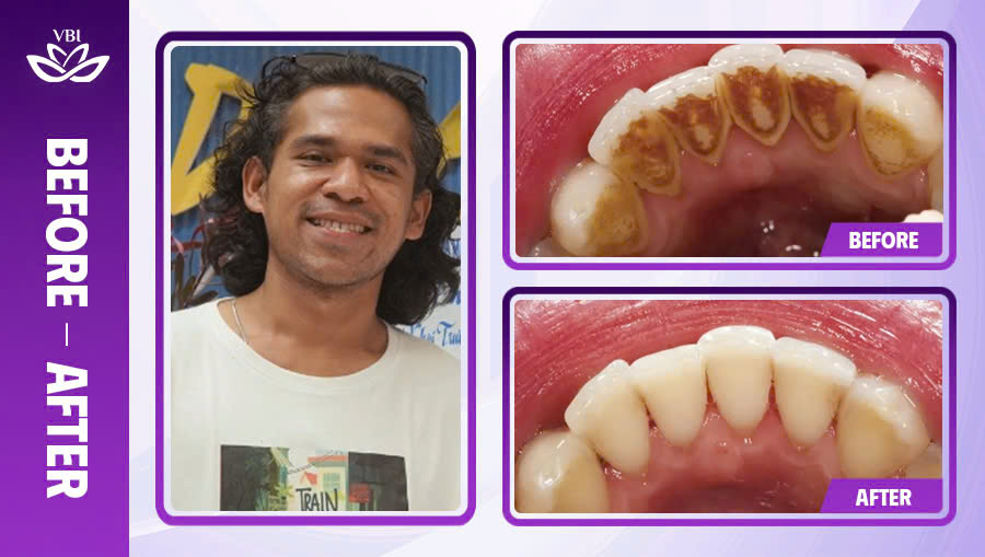 z7328102592828_ef4bc1a47628725f9c9ea384ebf7a515