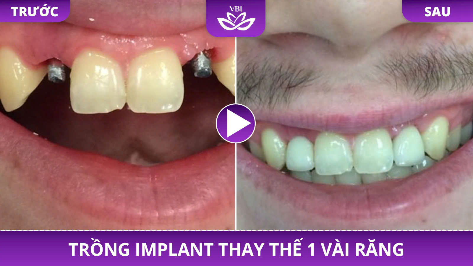 z7352583885438_3cb6d9828c9dd2299bd2deabc0d2c49c