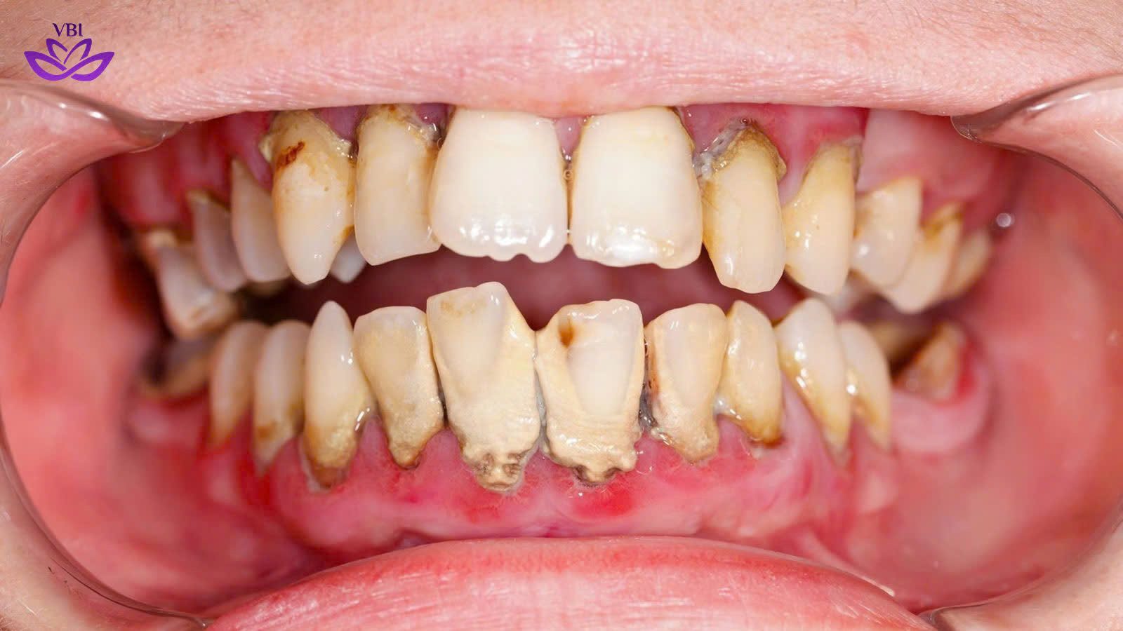 z7566073711352_00b6fb1b0592e807040dfdf714c5bc95