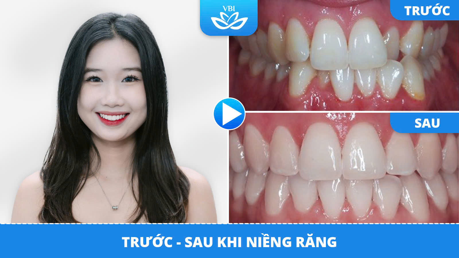 z7593032227913_80e4a28ca63c3ecf1afbd25cb0de559a