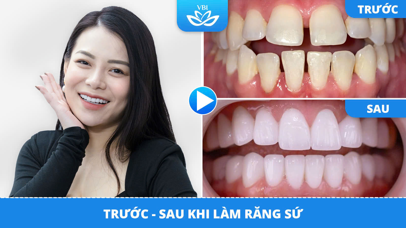 z7593032305925_bbdc311c224ff7ba4fcd2a8bfe1fc3a6