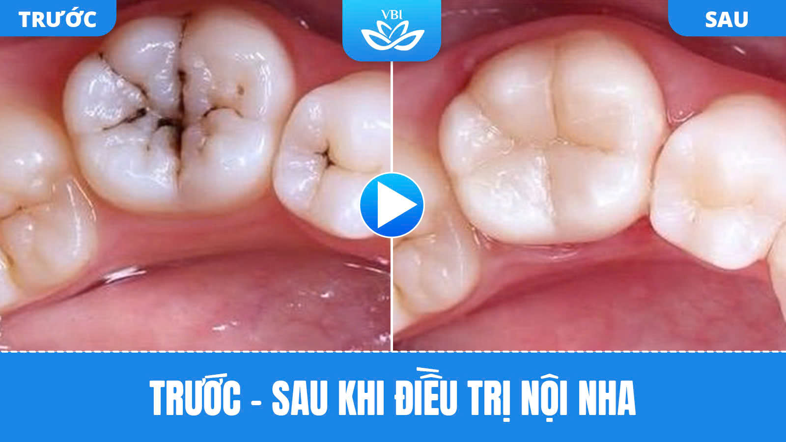 z7595285005335_314b09226d8edd1c9f6b6790a58f7d6d