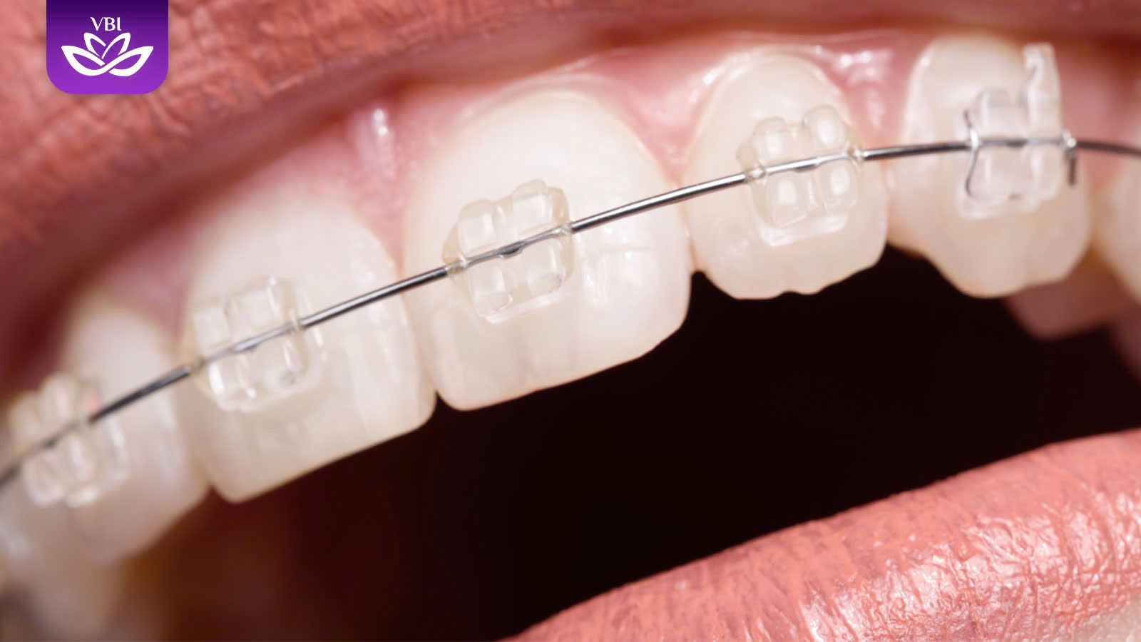 z7601717620793_829222dc9e6b9097a747262987452eb2