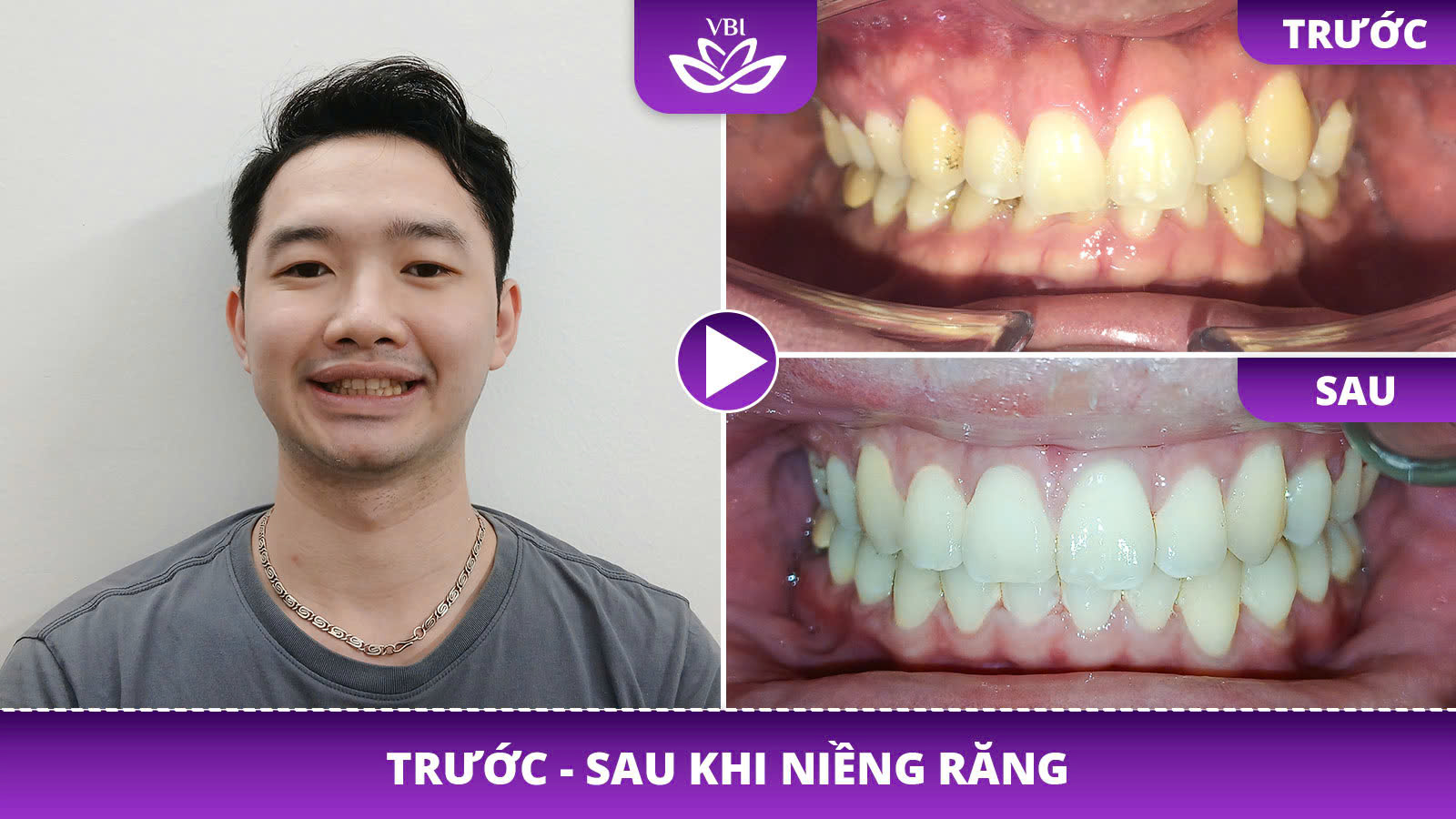 z7601717778898_3543f968f96fe8ebb400768161e2bbdb