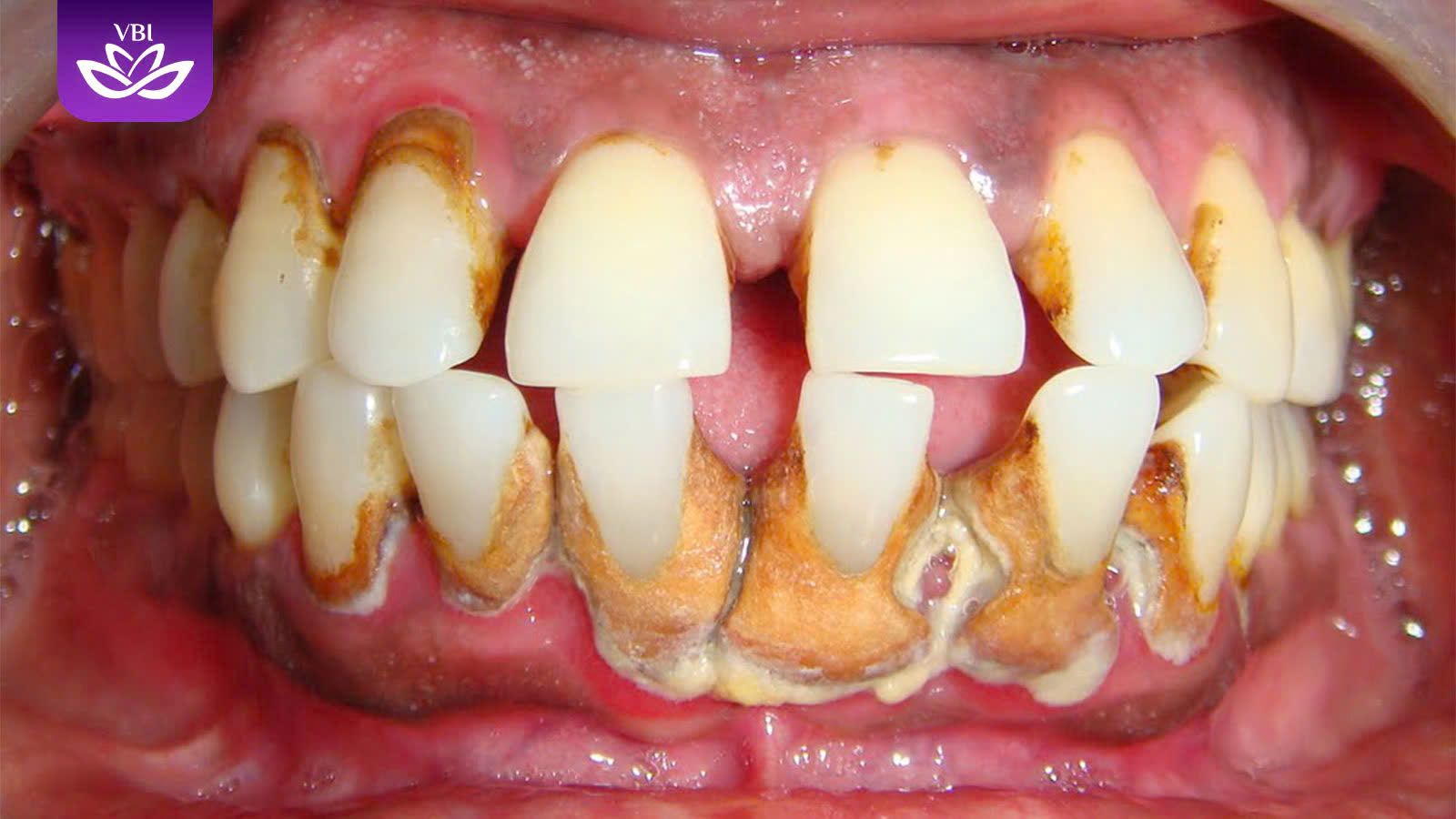 z7609959235768_e595cc8bf89f3d4ef17533a76e1b2f33