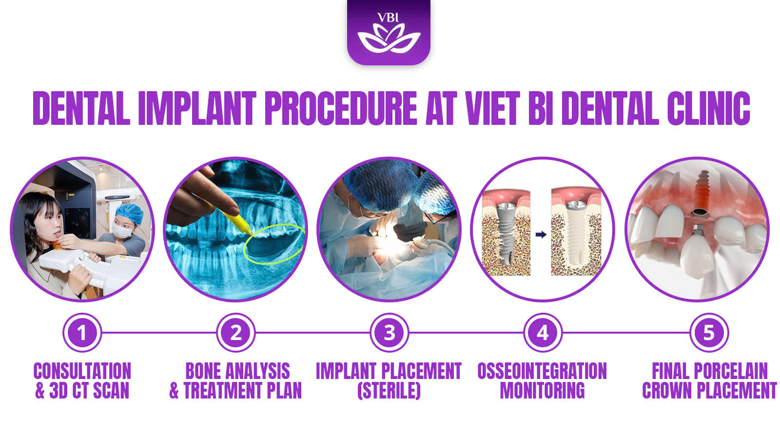 z7732000014818_3eedf89e25c449866786d4a528fff5a4