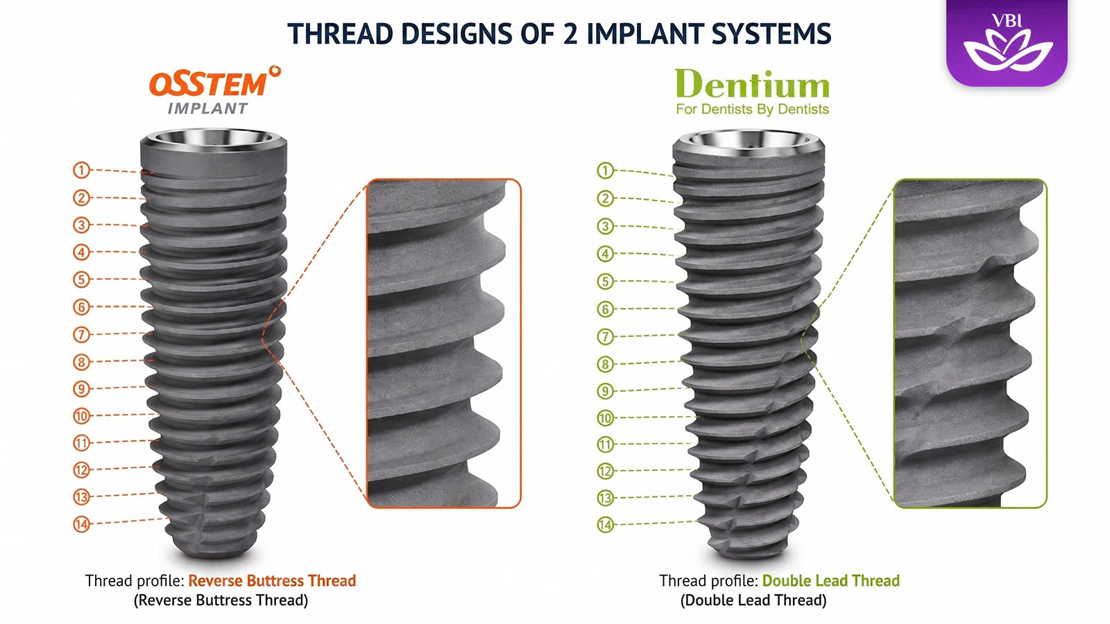 affordable korean dental implants in vietnam Osstem and Dentium thread design