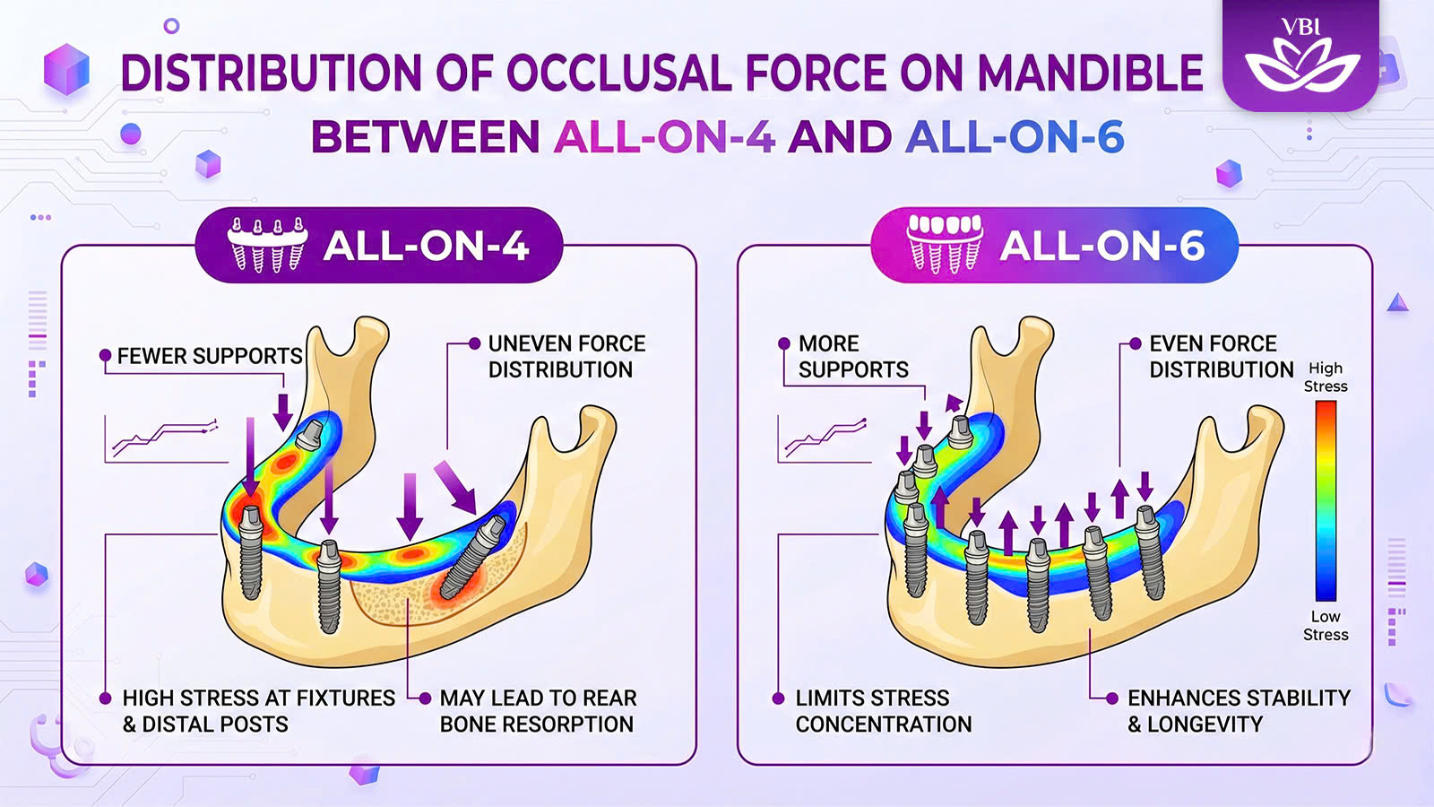 all on 4 vs 6 implants chewing force distribution