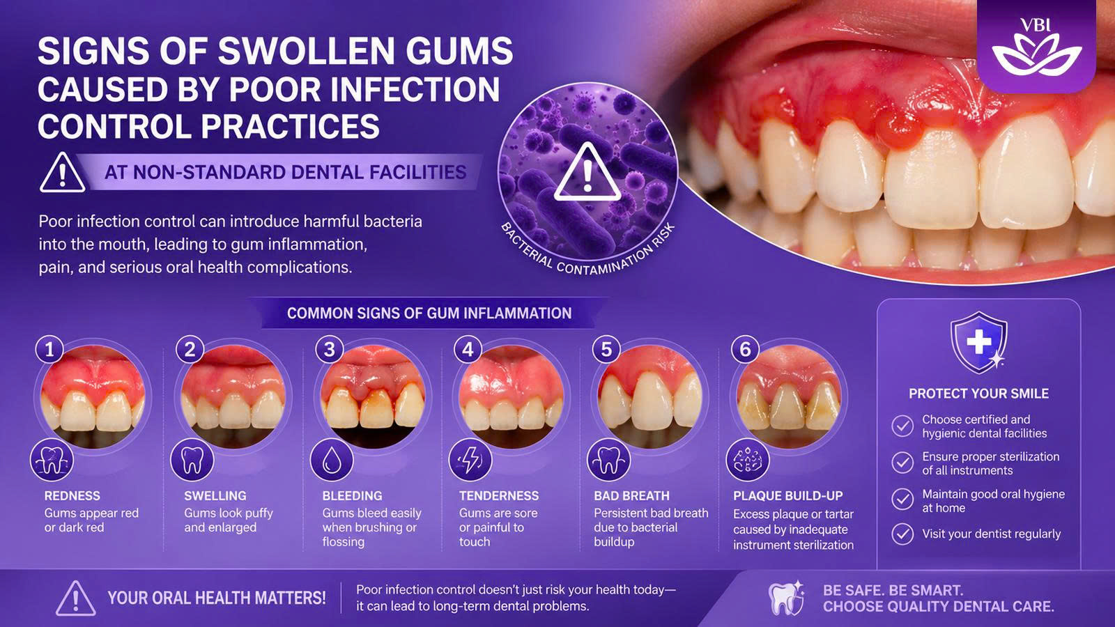 Clinical signs of severe swelling highlighting cheap dental implants risks