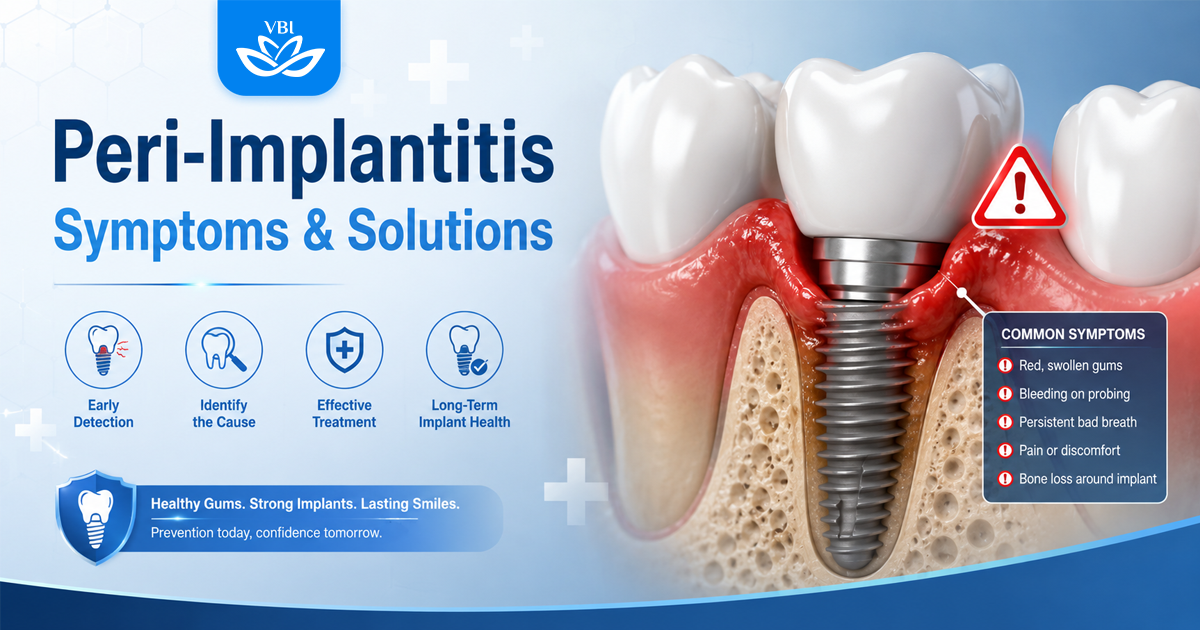 Dental Implant Failure Symptoms: Causes & How to Fix It