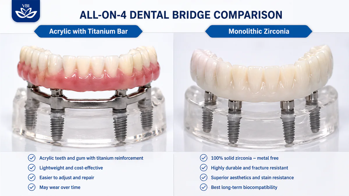 A detailed side-by-side comparison of two All-on-4 bridge materials: an acrylic resin prosthesis reinforced with a titanium bar and a monolithic solid zirconia bridge.
